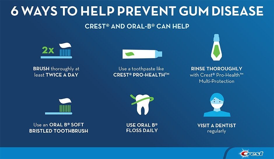 Ways to Prevent Gum Disease