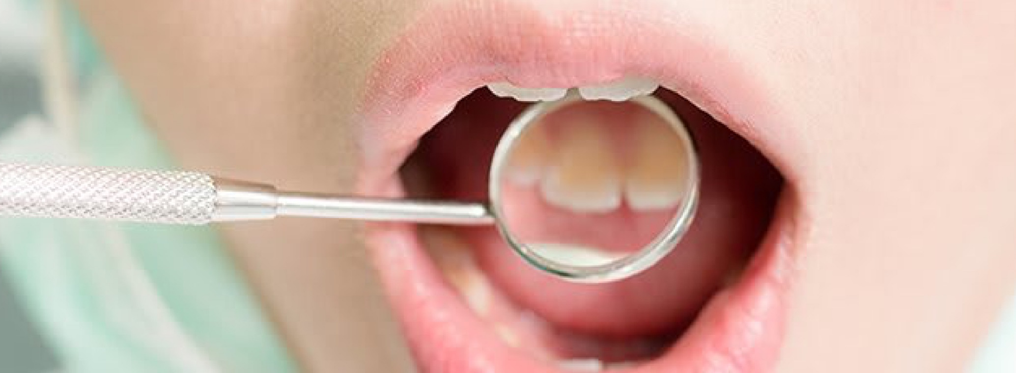 Why You Need To Get A Hole In Tooth Fixed