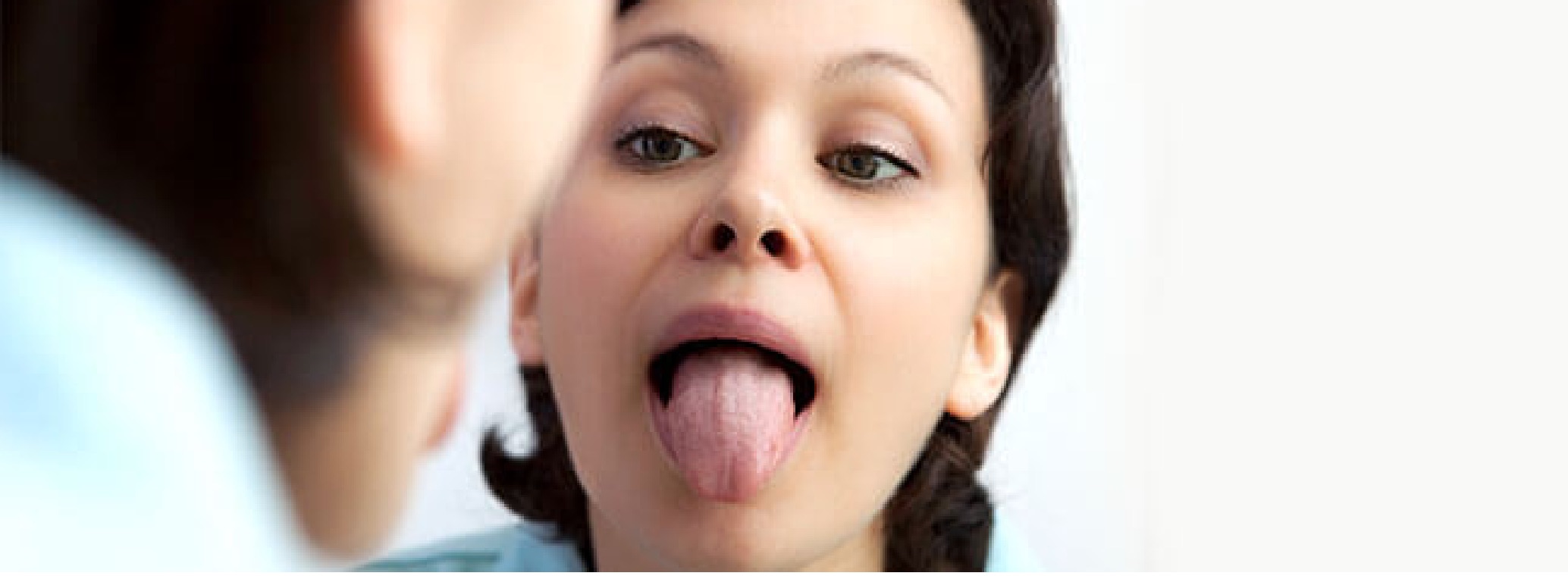  Tongue Bumps-Enlarged Papillae and Other Problems