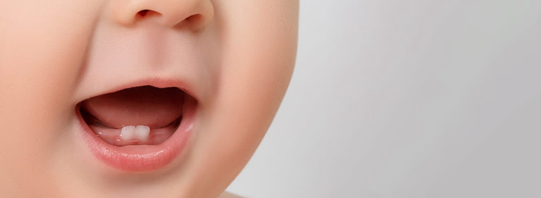 White or Brown Spots on Baby Teeth