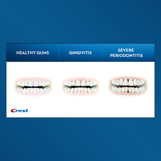 charcoal and gum disease