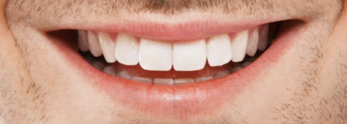 Myths about teeth whitening