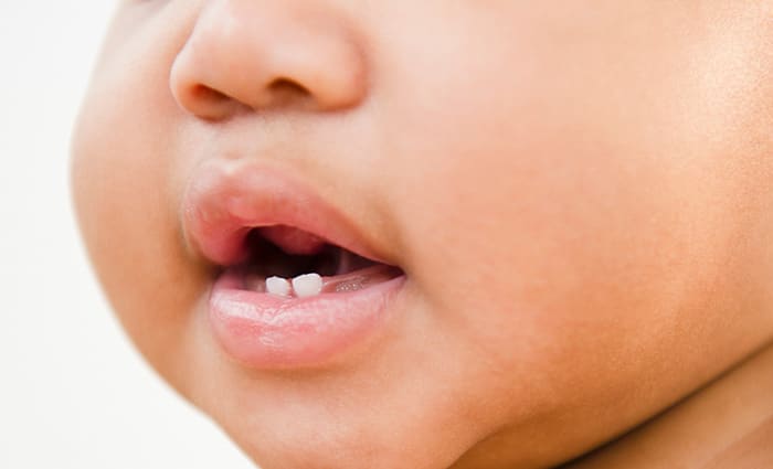 Teething Fever: Can teething cause fevers? 