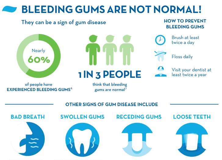 Bleeding Gums Are Not Normal