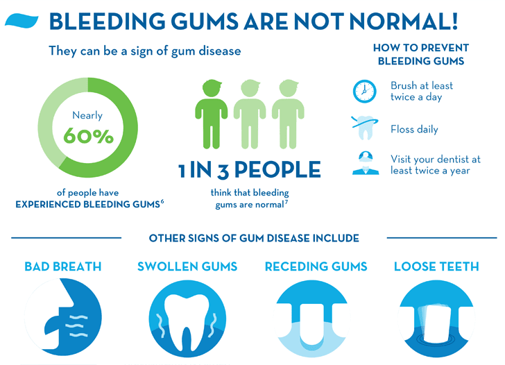 Bleeding Gums Causes Treatments And Prevention Crest