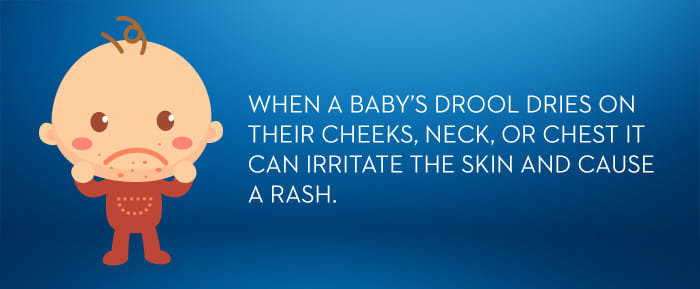 Why Your Baby Has Rash